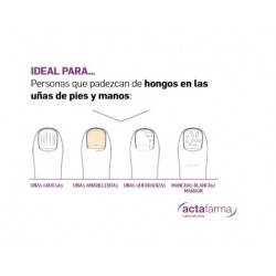 Tratamento antifúngico para unhas de mãos e pés UNGEASIL 3,5ml