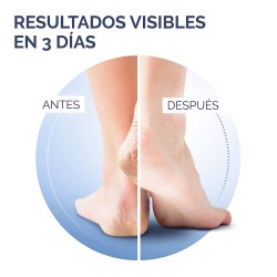 SCHOLL Creme Calcanhar Fissado Reparação Ativa K+ 60ml