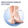 SCHOLL Cracked Heel Cream Active Repair K+ 60ml
