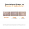 ISDIN Eryfotona AK-NMSC Fluide SPF 100+ 50 ml