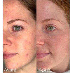 CAUDALIE Vinopure Anti-Imperfection Salicylserum 30ml