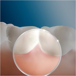 ORAL-B Oxyjet Munddusche Ersatzteile 4 Köpfe