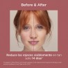 ISDIN FotoUltra Rossore SPF 50+ (50ml)