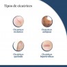 TROFOLASTIN Breast Scar Reducer 3x2 patches