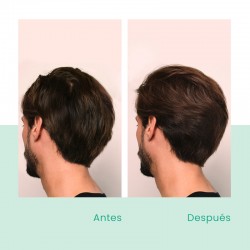 RENE FURTERER Shampoo anticaduta stimolante trifasico 2 x 200 ml