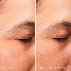 Medik8 Crystal Retinal Ceramide Eye 10 15 ml 【ACHAT EN LIGNE】