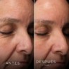 Medik8 HEO-Maske Einzelhandel 2 x 50 ml 【24 Stunden VERSAND】