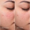 Medik8 Press & Clear 150 ml