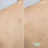 Freshly Cosmetics Traitement Corporel Actif Azelaic 100 ml