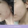 Freshly Cosmetics Azelaic Radiance Gesichtsbehandlung 50 ml