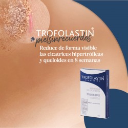 TROFOLASTIN Redutor de cicatriz periareolar 3x2 adesivos