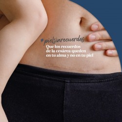 TROFOLASTIN Redutor de cicatriz periareolar 3x2 adesivos