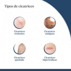 TROFOLASTIN Réducteur de cicatrices périaréolaires 3x2 patchs