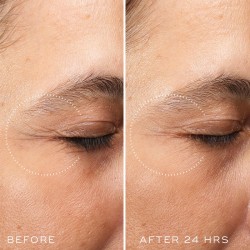 Medik8 Crystal Retinal Ceramide Eye 6 (15 ml)