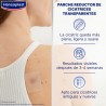 HANSAPLAST Scar Reducer 2x21 Verbände【SPARKPACK】