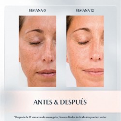 EUCERIN Anti-Pigment Dual Serum 3x30ml 【SPARKPAKET】