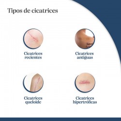TROFOLASTIN Post-partum 200 ml + Réducteur de cicatrices 4x30 cm