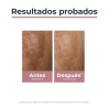 EUCERIN Anti-Pigment Dual Serum 30ml