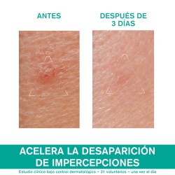 URIAGE Hyseac SOS Paste 15G