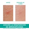URIAGE Hyseac SOS Paste 15G