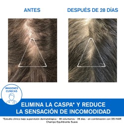 URIAGE DS Shampoo Anticaspa 200ml