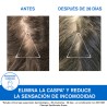 URIAGE DS Shampoing Antipelliculaire 200 ml