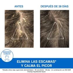 Acquista lo Shampoo Cheratoriduttivo Uriage DS al miglior prezzo