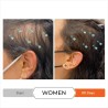 REVITA Après-shampoing Antichute Stimulant pour Cheveux 925 ml