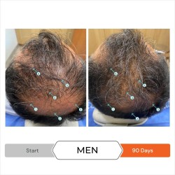 REVITA Après-shampoing Antichute Stimulant pour Cheveux 925 ml