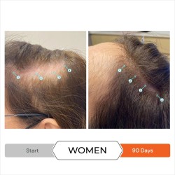 REVITA Après-shampoing Antichute Stimulant pour Cheveux 925 ml