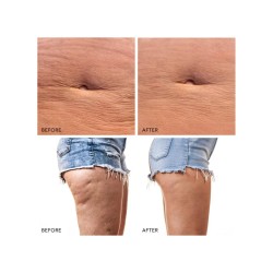 Appareil pour le corps Foreo Bear 2 1 pièce