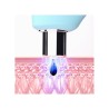 Foreo KIWI Blackhead Remover Blue LED Light 1 pc
