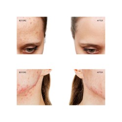 Foreo ESPADA 2 1 ud 【OFERTA】