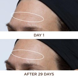 Perricone Cold Plasma Plus+ Face 30 ml