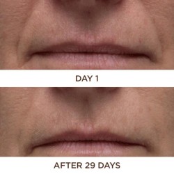 Perricone Cold Plasma Plus+ Face 30 ml