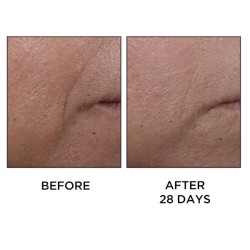 Perricone Cold Plasma Plus+ Face 30 ml