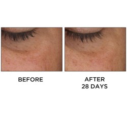 Perricone Cold Plasma Plus+ Eye 15 ml