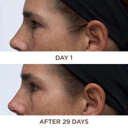 Perricone Cold Plasma Plus+ Eye 15 ml