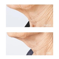 Perricone Cold Plasma Plus+ Sub-D/Neck 59 ml