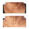 Perricone Cold Plasma Plus+ Sub-D/Neck 59 ml
