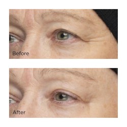 Perricone Cold Plasma Plus+ The Intensive Hydrating Complex 59 ml