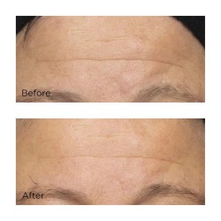 Perricone Cold Plasma Plus+ The Intensive Hydrating Complex 59 ml