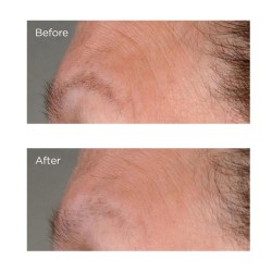Perricone High Potency Growth Factor Firming & Lifting Serum 59 ml