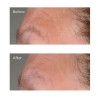 Perricone High Potency Growth Factor Firming & Lifting Serum 59 ml