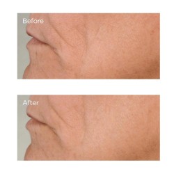 Perricone High Potency Growth Factor Firming & Lifting Serum 59 ml