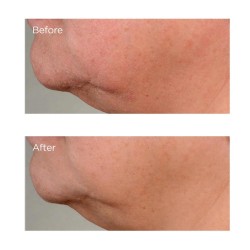 Perricone High Potency Growth Factor Firming & Lifting Serum 59 ml