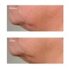 Perricone High Potency Growth Factor Firming & Lifting Serum 59 ml