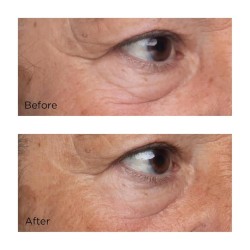 Sérum contour des yeux raffermissant et liftant Perricone High Potency Growth Factor 15 ml