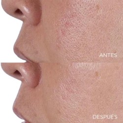 Tonique visage finition et raffermissant haute puissance Perricone 118 ml