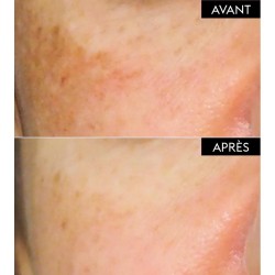 Patyka Pack Sérum Corrector Antimanchas 30 ml + Fluido Antimanchas Alta Protección SPF30 40 ml